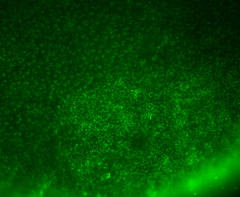 Fluorescence micrograph of the chicken heart expressing cytoplasmic GFP